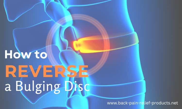 how to treat a bulging disc at home