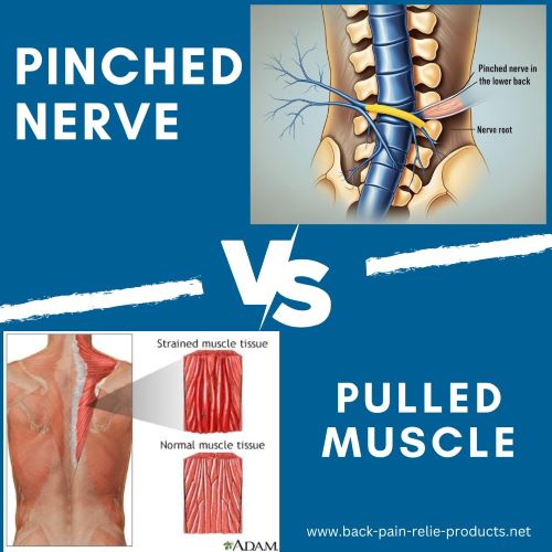 pinched nerve or strained muscle